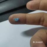 吃生煎吃出个不明物体[发呆]