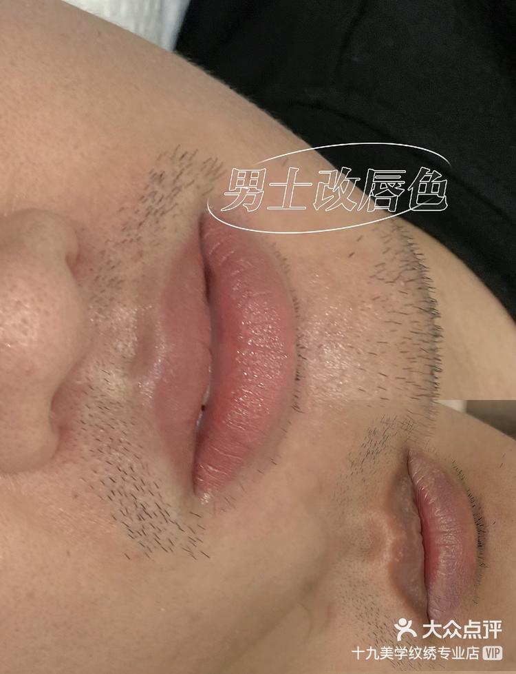 了显年轻又干净男生要以自然为主色素矫正#欧洲漂唇 #漂唇 #男士漂唇