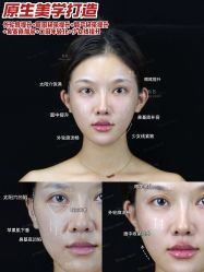 -Yestar宁波艺星整形医院