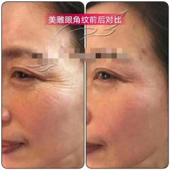 -兰派国际美容养生SPA