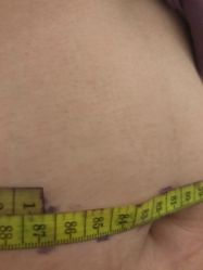 -肥三针腧穴瘦身馆