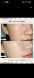 点击看大图 -SKIN79皮肤管理中心