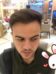 点击看大图 -大麦微针植发丨全国连锁