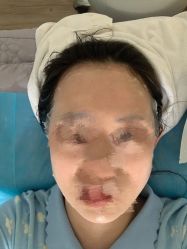 -小忠丽格医美