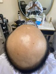 -唐风采假发补发定制