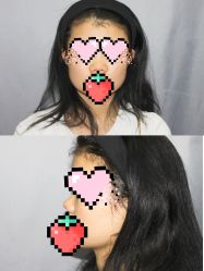 体验前-深圳阳光医疗美容医院·旗舰店