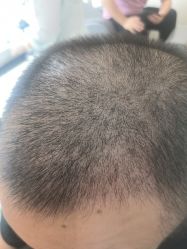 -雍禾植发
