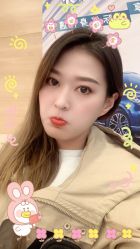 体验后-天津健丽·去眼袋医疗美容机构