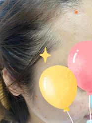 -百年美肤堂祛痦痣祛斑祛疣
