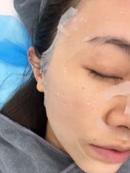 体验后-澳尔颜选医疗美容