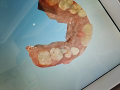 -Dr.Z dental仁康种植矫正中心