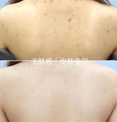 -美肤盾祛痘·问题肌头疗管理中心