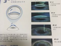 -上海大学附属上海和平眼科医院