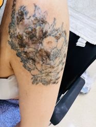 -净肤洗纹身