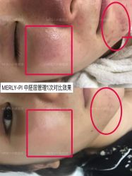 -MLP美丽派·问题肌疗愈中心