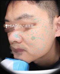 -韩国淼美颜皮肤管理官方直营店