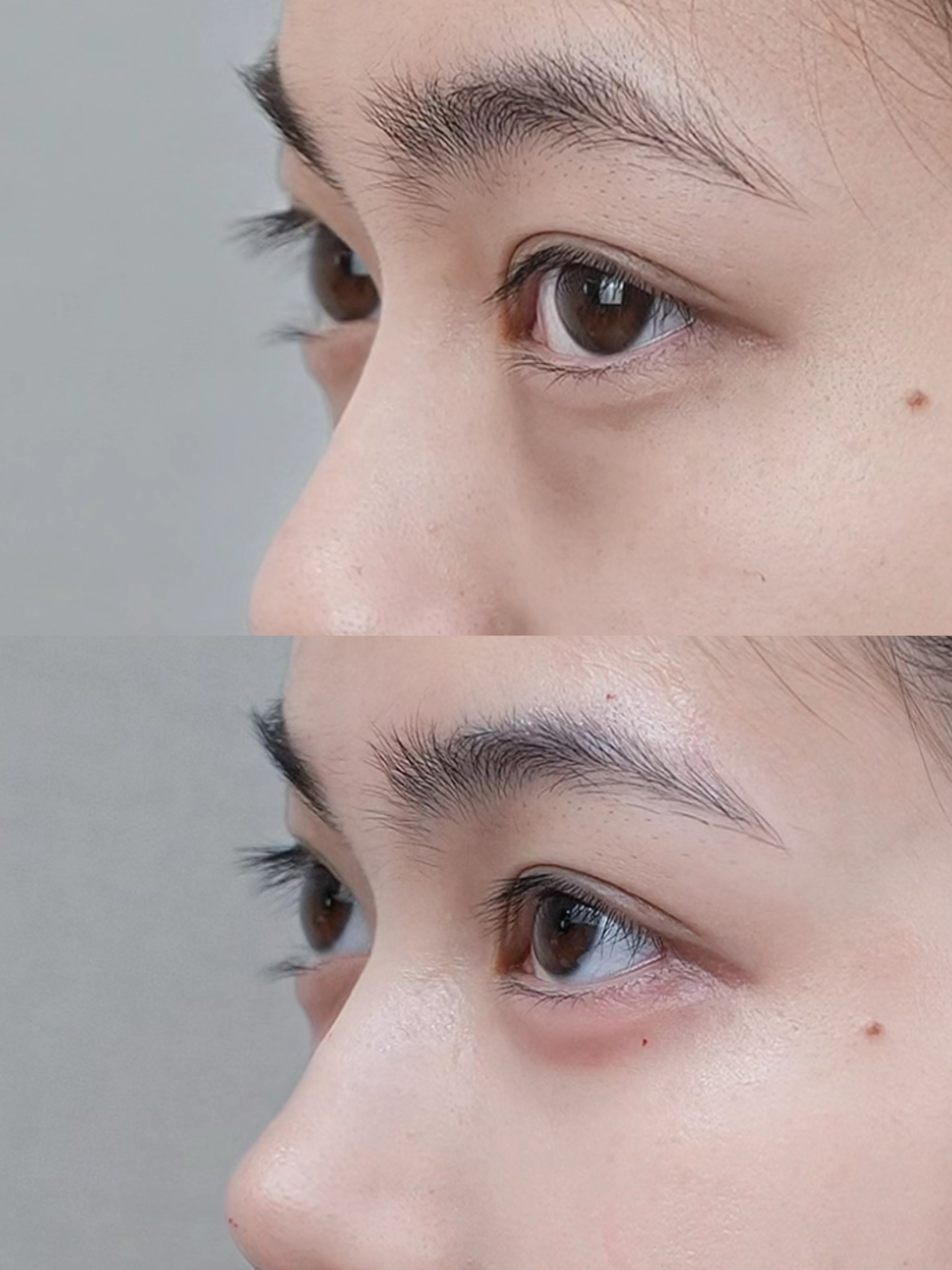 在杭州终于遇到卧蚕打得好的神仙医生了