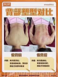 -丽减美瘦吧·减肥瘦身