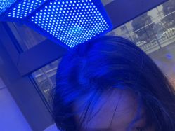 -碧莲盛·不剃发植发