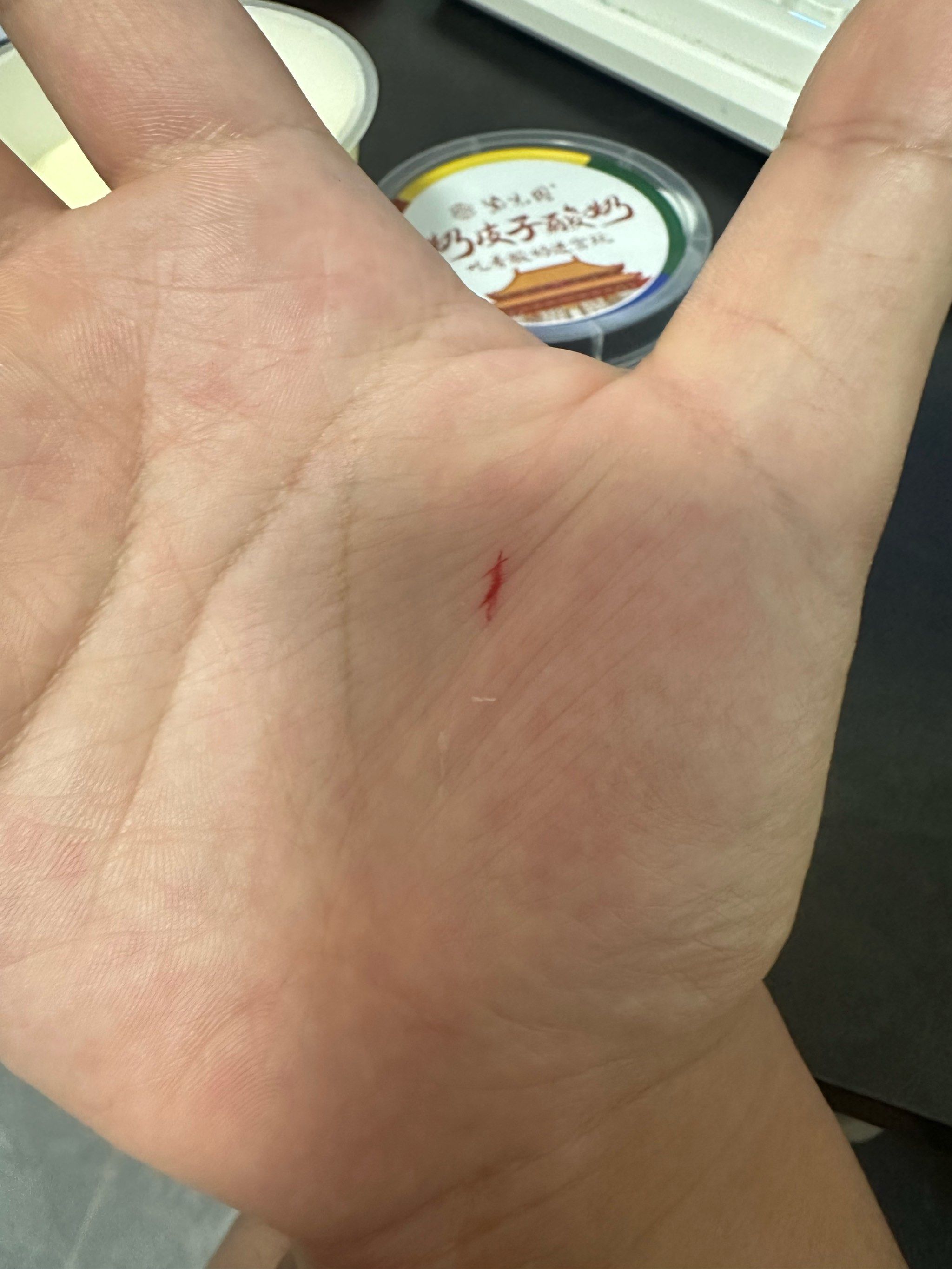 酸奶外卖直接把手划破