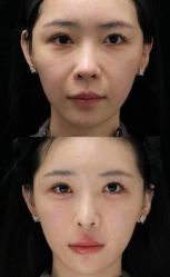 点击看大图 -Yestar艺星医疗美容医院