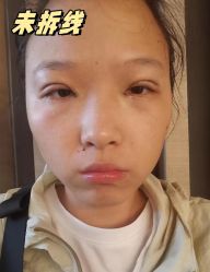 -素美医疗美容·西南眼鼻整形·修复基地