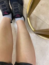 体验后-伊丽莎白医疗美容