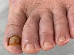 -世龙世家手足健康护理连锁(福田梅林路润裕花园店)