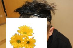 -大麦微针植发丨全国连锁