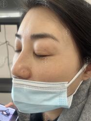 -清疣美疣·痣·斑净肤中心