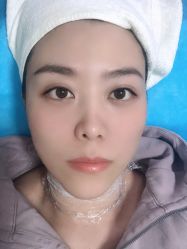 体验前-北京丽星翼美医疗美容