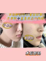 点击看大图 体验后-八大处整形