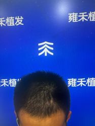 -雍禾植发全国连锁