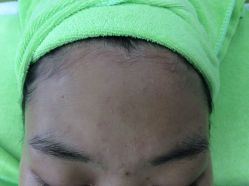 -苗医生草本科技祛痘