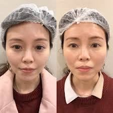 -SKINIST丽铂医疗美容