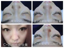 点击看大图 睫毛嫁接-光SPA科技美肤