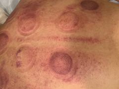 -承启堂中医馆·推拿·针灸(成华馆)