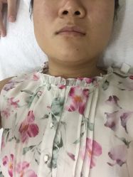 -苗方清颜专业祛痘