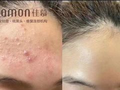 -中粮·祥云小镇