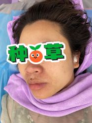 体验后-天其美科学美肤·生发健康管理