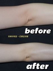 -慕颜医疗美容·皮肤微整 抗衰