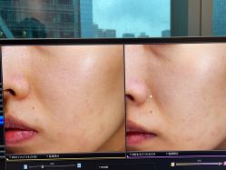 -丽美妍医疗美容·皮秒·立体分层抗衰