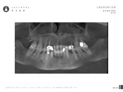 -齐玉齿科JADENTAL
