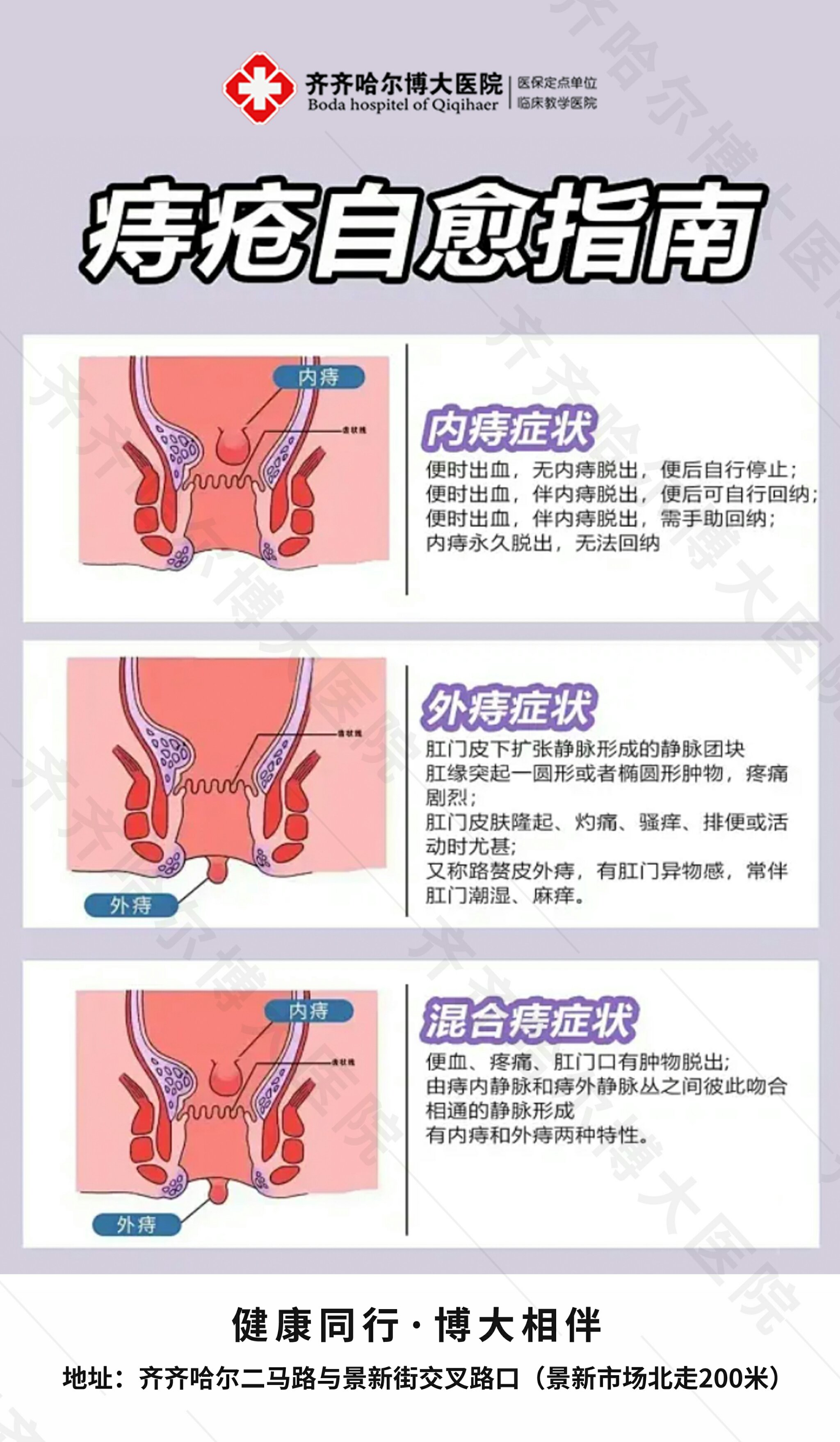 内痔疮自愈图片