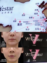 -Yestar重庆艺星医疗美容医院