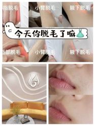 -MUSES专业脱毛比基尼サロン日式连锁