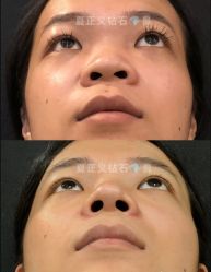 -北京米扬丽格医疗美容·联合丽格鼻整形中心