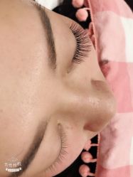 -郡艺医疗美容·微整·眼鼻吸脂