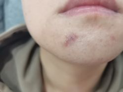 -苏亚医美·高端注射明星整形机构