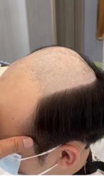 -发饰美男士增发补发假发定制店